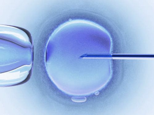 fecundacion-in-vitro-reproduccion-asistida.jpg