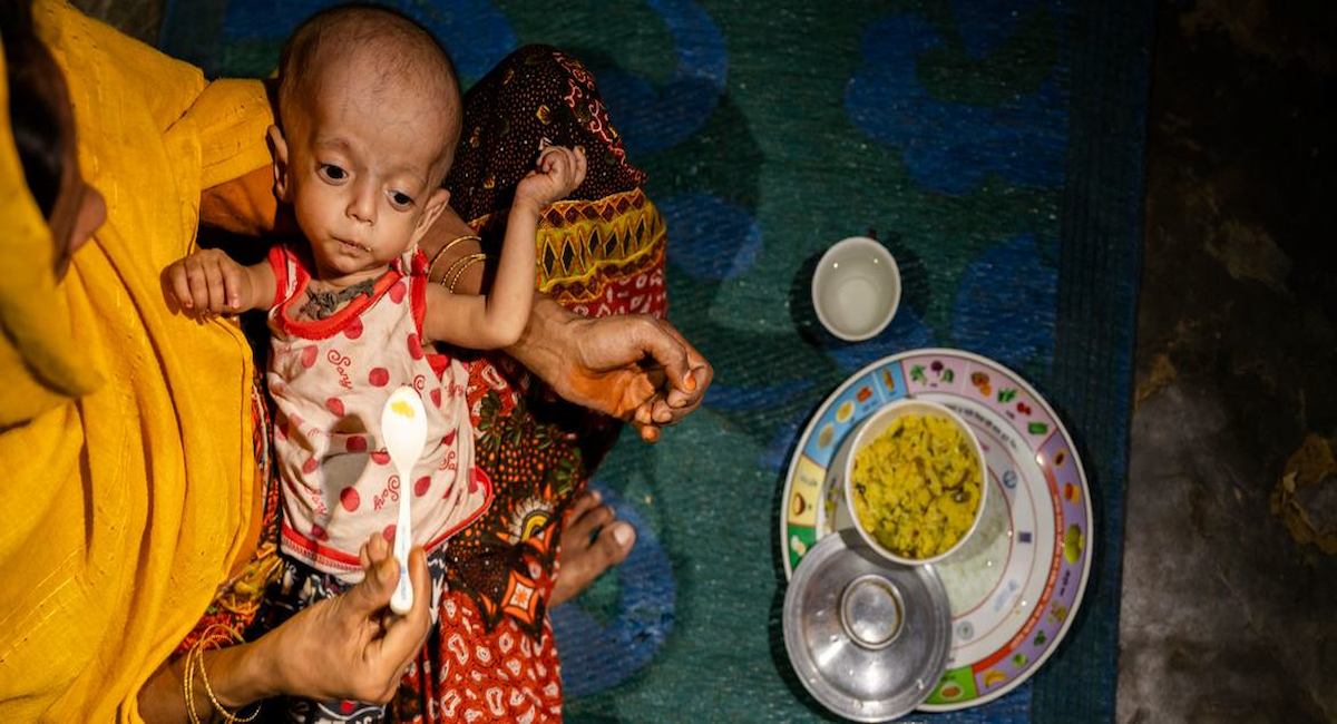 Sólo la mitad de los niños que lo necesitan tendrán acceso a tratamiento contra el hambre y la desnutrición este año | Foto: UNICEF/Ilvy Njiokiktjien