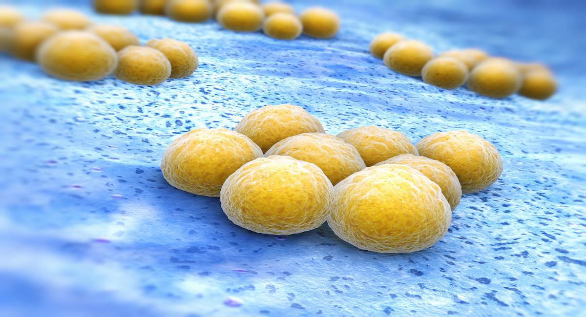 ‘Staphylococcus aureus’ resistente provoca graves infecciones hospitalarias, como septicemia, y es el centro de la estrategia en innovación terapéutica en desarrollo. | Foto iStock