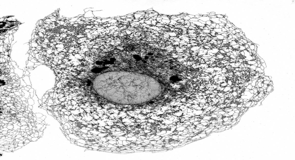 Microscopía confocal de alta resolución del retículo endoplásmico de una de las células de riñón de mono verde. | Foto: Miguel Sánchez (IIBM-CSIC-UAM)