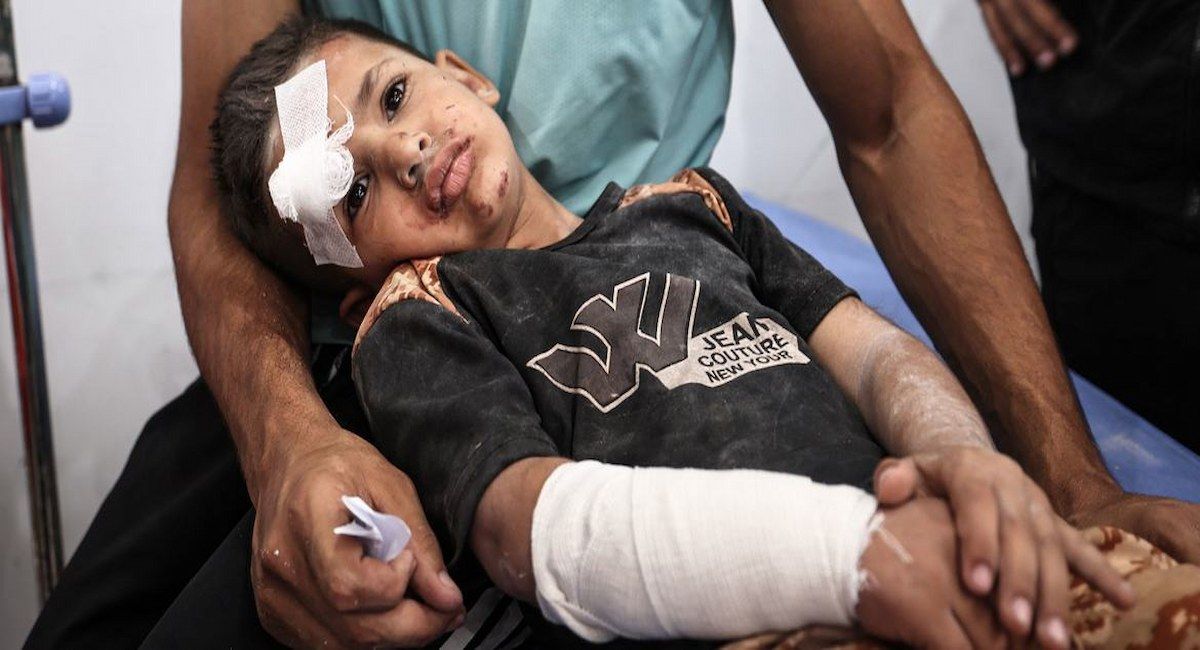 Un niño gazatí herido en el genocidio de Netanyahu | Foto: UNICEF/Eyad El Baba Europa