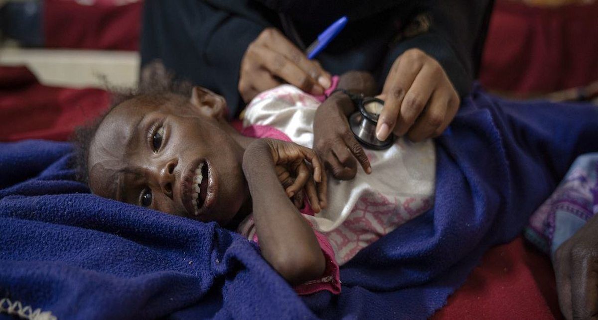 Un niño de tres años recibe tratamiento por desnutrición en un hospital de Omdurman, Sudán. | Foto:  Avaaz/Giles Clarke