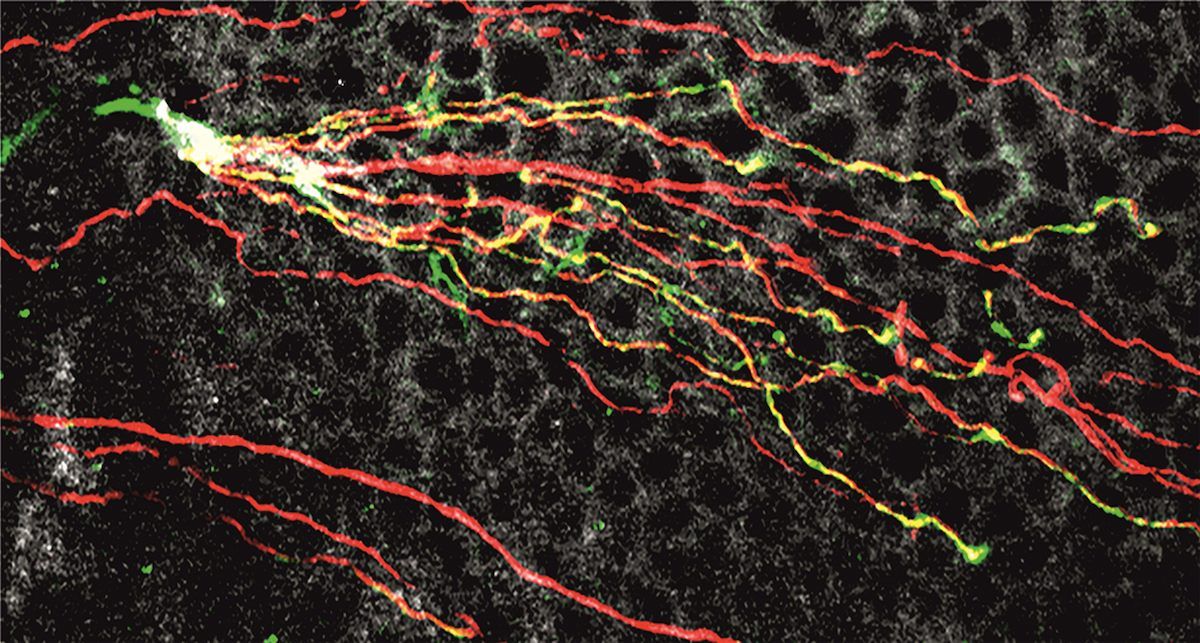 Fibras nerviosas de la córnea de ratón obtenidas mediante microscopía confocal para la investigación de esta molécula. | Foto: IN CSIC-UMH