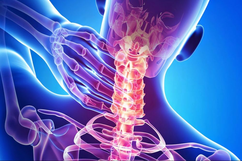 Cervicalgia
