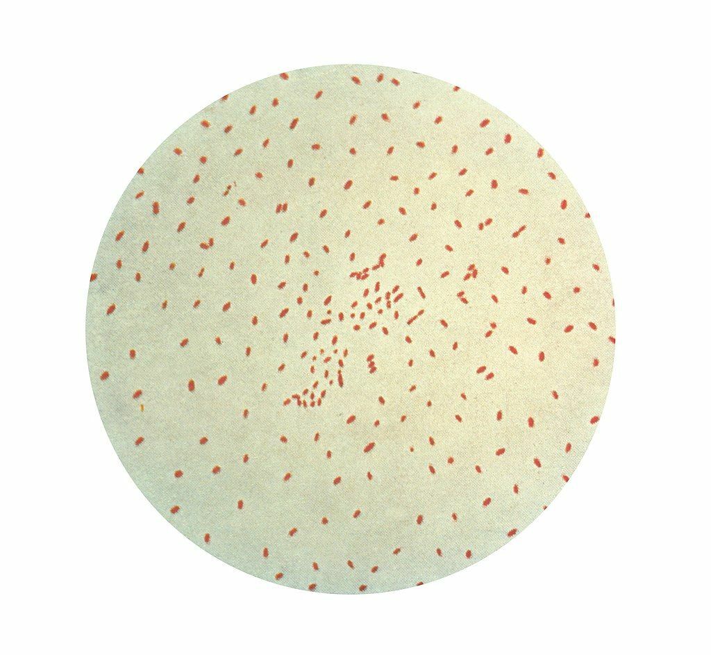 Bordetella_pertussis